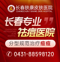 长春皮肤病医院线上问诊痘坑能修复到原来皮肤吗